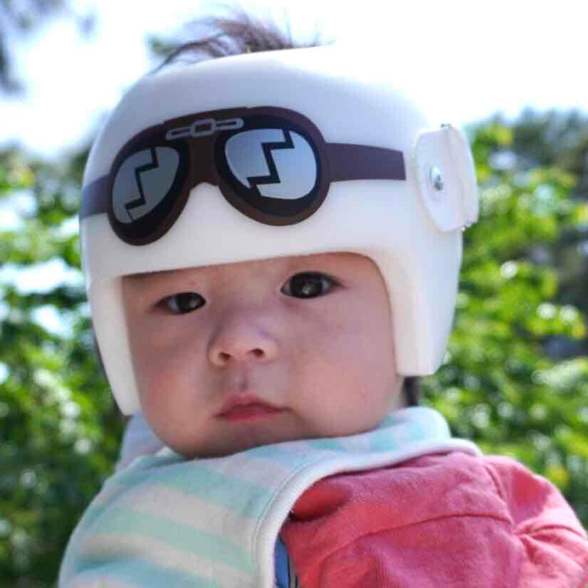Goggles